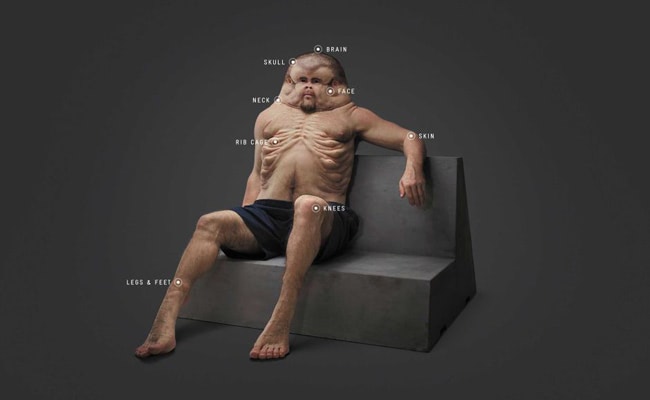 A road safety campaign exposes a confronting picture to highlight the vulnerable human body on the road