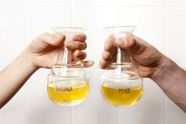 urine vials