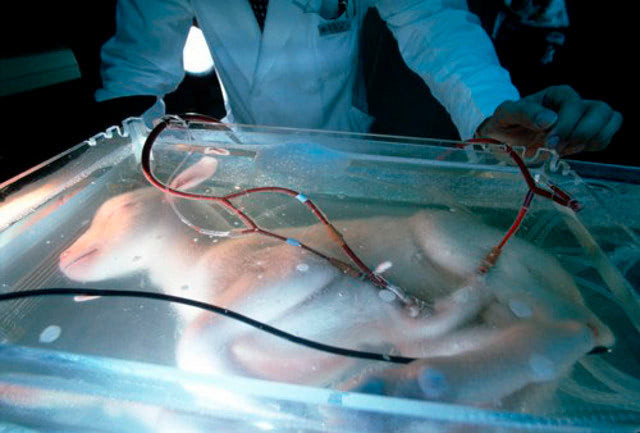 Visual of The birth of the artificial womb