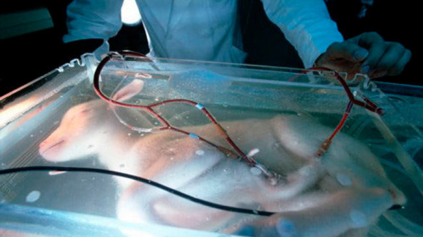 Visual of The birth of the artificial womb