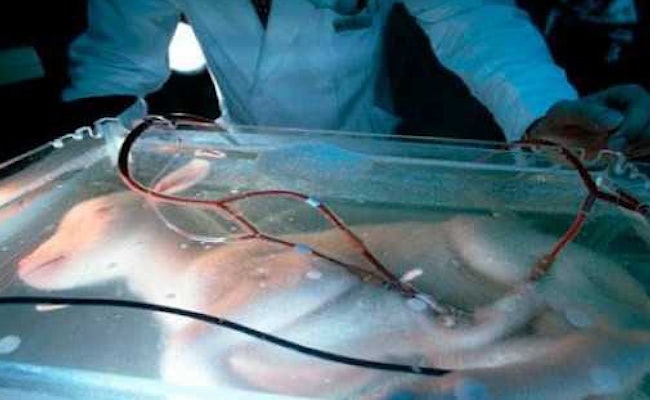 Visual of 1996 - First Artificial Womb Experimented