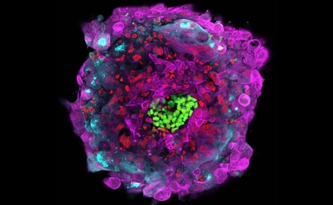 Visual of 2016 - Human Embryo Lives 13 Days in Lab