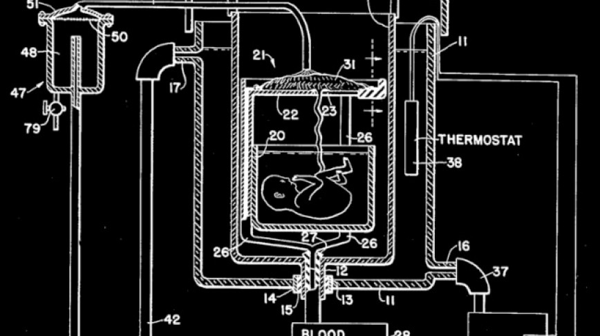 Visual of 1955 - Artificial Womb Drawing Patented