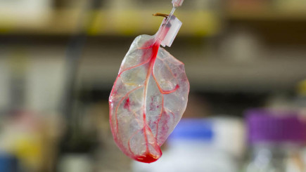 Visual of Heart Repair with Spinach Leaves