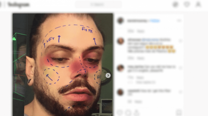 Visual of Instagram will remove filters promoting cosmetic surgery