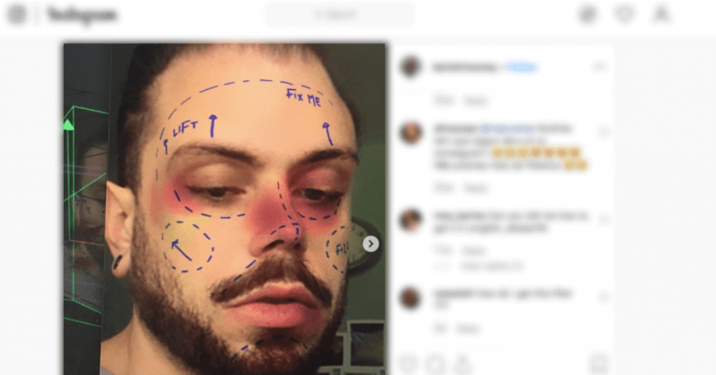 Visual of Instagram will remove filters promoting cosmetic surgery amid mental health concerns
